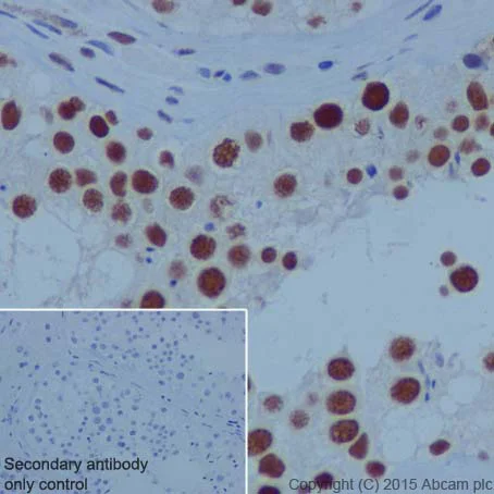 Immunohistochemistry (Formalin/PFA-fixed paraffin-embedded sections) - Anti-PARP1 antibody [EPR18461] - BSA and Azide free (AB222234)
