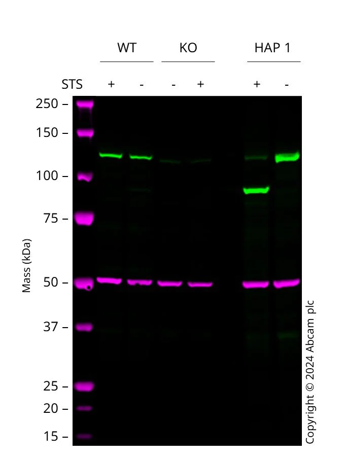 Western blot - Anti-PARP1 antibody [EPR18461] - BSA and Azide free (AB222234)