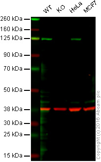 Western blot - Anti-PARP1 antibody [Y17] (AB32378), expandable thumbnail