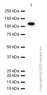 Western blot - Anti-PARP1 antibody [Y17] (AB32378)