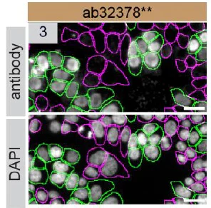 Immunocytochemistry/ Immunofluorescence - Anti-PARP1 antibody [Y17] - BSA and Azide free (AB284670)