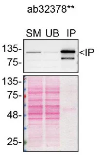 Immunoprecipitation - Anti-PARP1 antibody [Y17] - BSA and Azide free (AB284670)