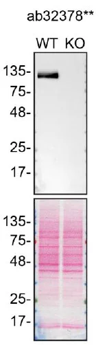 Western blot - Anti-PARP1 antibody [Y17] - BSA and Azide free (AB284670)