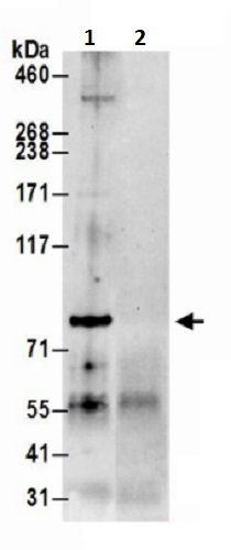 Immunoprecipitation - Anti-PARP12 antibody (AB241967)