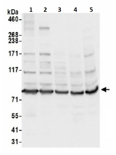 Western blot - Anti-PARP12 antibody (AB241967)