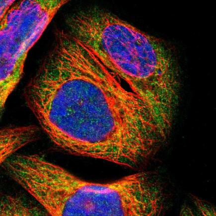 Immunocytochemistry/ Immunofluorescence - Anti-PARP14 antibody (AB224352), expandable thumbnail