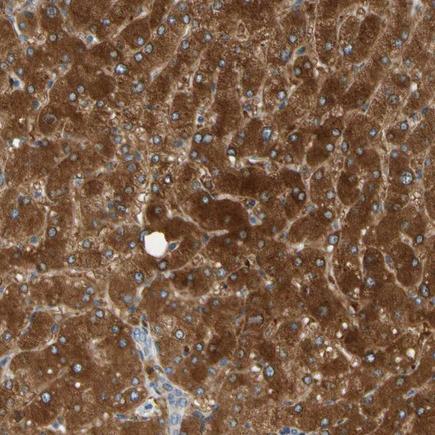Immunohistochemistry (Formalin/PFA-fixed paraffin-embedded sections) - Anti-PARP14 antibody (AB224352), expandable thumbnail