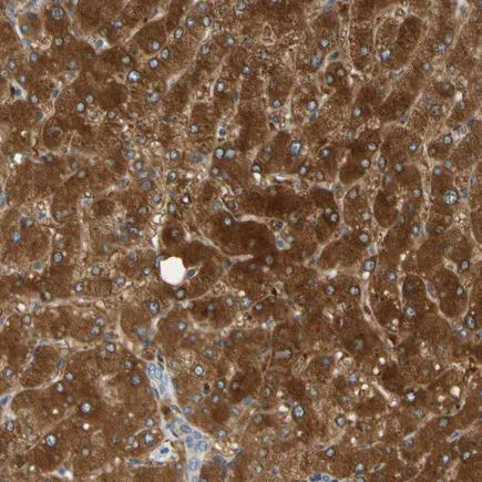 Immunohistochemistry (Formalin/PFA-fixed paraffin-embedded sections) - Anti-PARP14 antibody (AB224352)