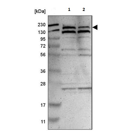 Western blot - Anti-PARP14 antibody (AB224352), expandable thumbnail