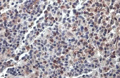 Immunohistochemistry (Formalin/PFA-fixed paraffin-embedded sections) - Anti-PARP14 antibody - C-terminal (AB229756)