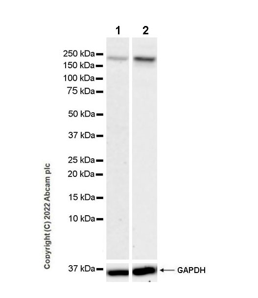 Western blot - Anti-PARP14 antibody [EPR26299-91] - BSA and Azide free (AB302711), expandable thumbnail