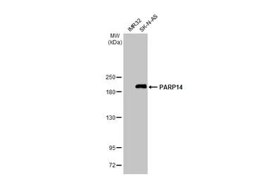 Western blot - Anti-PARP14 antibody [HL1178] - BSA and Azide free (AB313832)