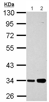 Western blot - Anti-PARP16 antibody (AB154510), expandable thumbnail