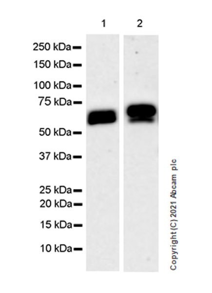 Western blot - Anti-PARP2 antibody [EPR24240-29] (AB271080)