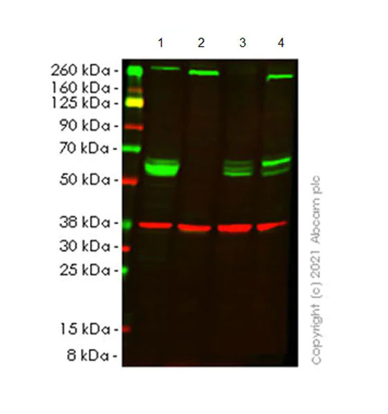 Western blot - Anti-PARP2 antibody [EPR24240-29] - BSA and Azide free (AB287161)