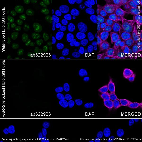 Immunocytochemistry/ Immunofluorescence - Anti-PARP2 antibody [EPR29698-102] (AB322923)