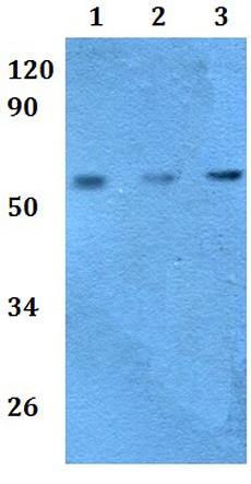 Western blot - Anti-PARP3/IRT1 antibody (AB201099), expandable thumbnail