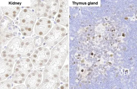Immunohistochemistry (Formalin/PFA-fixed paraffin-embedded sections) - Anti-PARP3/IRT1 antibody [HL1509] - BSA and Azide free (AB313860)