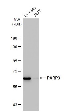 Western blot - Anti-PARP3/IRT1 antibody [HL1509] - BSA and Azide free (AB313860), expandable thumbnail
