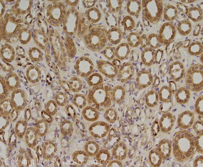 Immunohistochemistry (Formalin/PFA-fixed paraffin-embedded sections) - Anti-PARP4 antibody [P193-10] (AB24110), expandable thumbnail