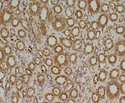 Immunohistochemistry (Formalin/PFA-fixed paraffin-embedded sections) - Anti-PARP4 antibody [P193-10] (AB24110)