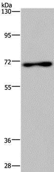 Western blot - Anti-PARP7 antibody - N-terminal (AB200390)
