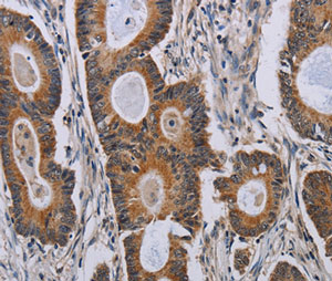 Immunohistochemistry (Formalin/PFA-fixed paraffin-embedded sections) - Anti-PARP8 antibody - C-terminal (AB200395), expandable thumbnail