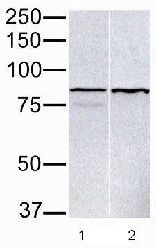 Western blot - Anti-PARP9 antibody (AB53796)