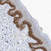 Immunohistochemistry (Formalin/PFA-fixed paraffin-embedded sections) - Anti-Partitioning defective 3-like protein antibody (AB122264)