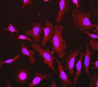 Immunocytochemistry/ Immunofluorescence - Anti-PARVA (phospho S8) antibody [EPR2174] (AB79409)
