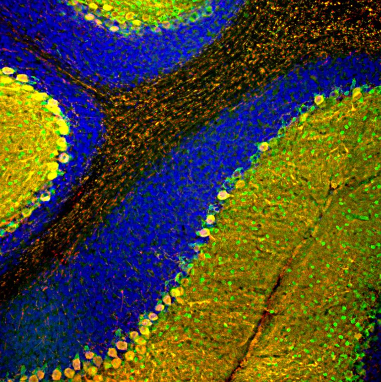 Immunohistochemistry - Free Floating - Anti-Parvalbumin antibody [3C9] (AB277625)