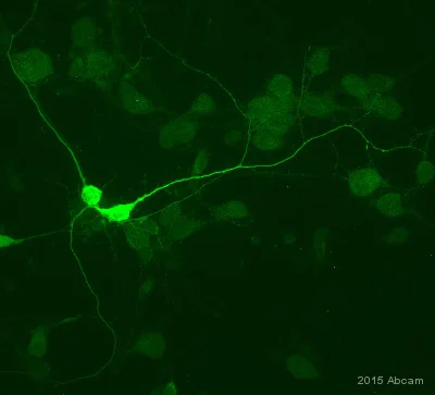 Immunocytochemistry/ Immunofluorescence - Anti-Parvalbumin antibody (AB11427)