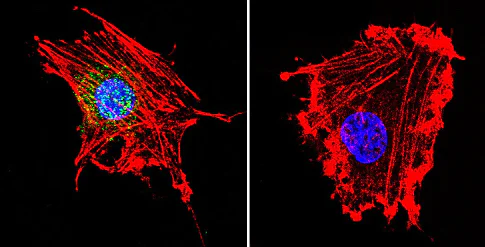 Immunocytochemistry/ Immunofluorescence - Anti-Parvalbumin antibody (AB11427)