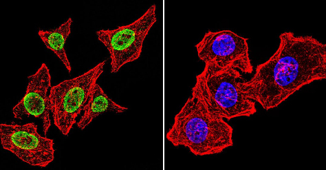 Immunocytochemistry/ Immunofluorescence - Anti-Parvalbumin antibody (AB11427)