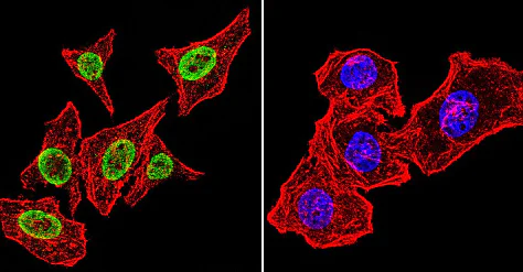 Immunocytochemistry/ Immunofluorescence - Anti-Parvalbumin antibody (AB11427)