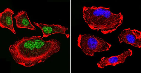 Immunocytochemistry/ Immunofluorescence - Anti-Parvalbumin antibody (AB11427)