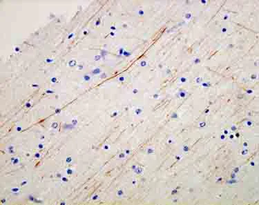 Immunohistochemistry (Formalin/PFA-fixed paraffin-embedded sections) - Anti-Parvalbumin antibody (AB11427)