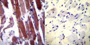 Immunohistochemistry (Formalin/PFA-fixed paraffin-embedded sections) - Anti-Parvalbumin antibody (AB11427)