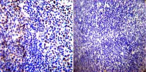 Immunohistochemistry (Formalin/PFA-fixed paraffin-embedded sections) - Anti-Parvalbumin antibody (AB11427)