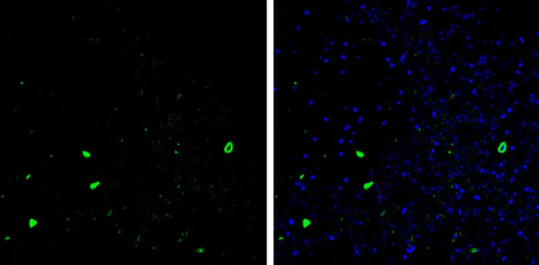 Anti-Parvalbumin antibody (ab256811) | Abcam