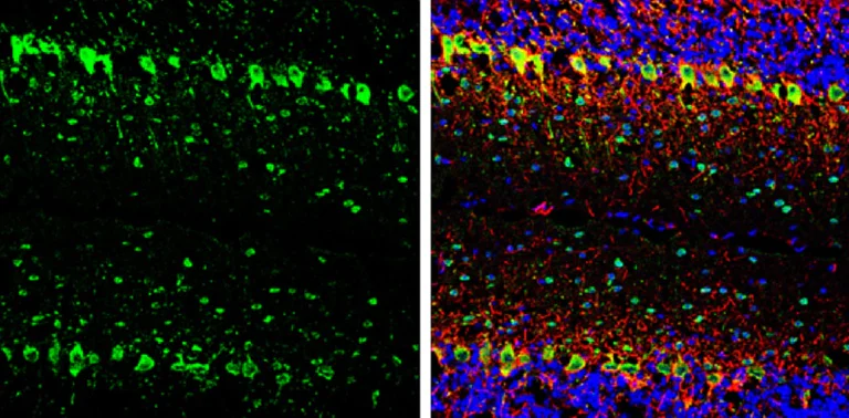Immunohistochemistry (Frozen sections) - Anti-Parvalbumin antibody (AB256811)