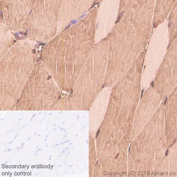 Immunohistochemistry (Formalin/PFA-fixed paraffin-embedded sections) - Anti-Parvalbumin antibody [EPR13091] (AB181086)