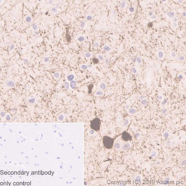 Immunohistochemistry (Formalin/PFA-fixed paraffin-embedded sections) - Anti-Parvalbumin antibody [EPR13091] (AB181086), expandable thumbnail