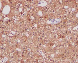 Immunohistochemistry (Formalin/PFA-fixed paraffin-embedded sections) - Anti-Parvalbumin antibody [EPR13091] (AB181086)