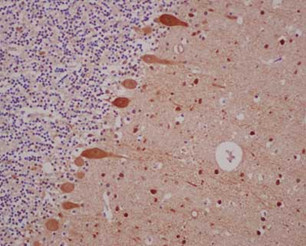 Immunohistochemistry (Formalin/PFA-fixed paraffin-embedded sections) - Anti-Parvalbumin antibody [EPR13091] (ab181086), expandable thumbnail