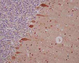 Immunohistochemistry (Formalin/PFA-fixed paraffin-embedded sections) - Anti-Parvalbumin antibody [EPR13091] (AB181086)