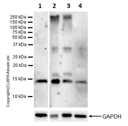 Western blot - Anti-Parvalbumin antibody [EPR13091] (ab181086), expandable thumbnail