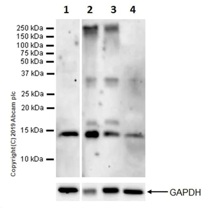 Western blot - Anti-Parvalbumin antibody [EPR13091] (AB181086)