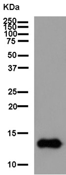 Western blot - Anti-Parvalbumin antibody [EPR13091] (ab181086), expandable thumbnail