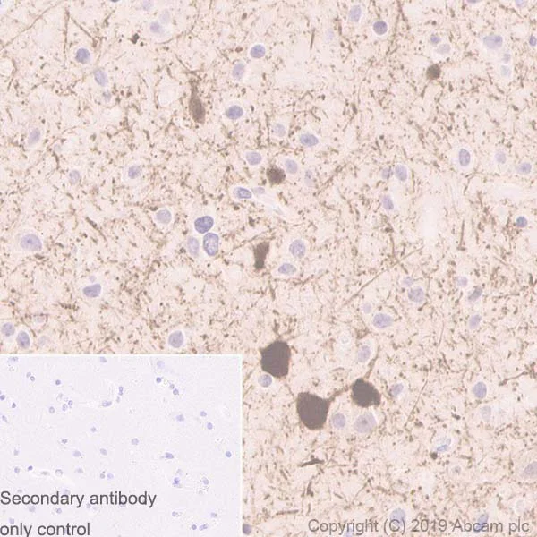 Immunohistochemistry (Formalin/PFA-fixed paraffin-embedded sections) - Anti-Parvalbumin antibody [EPR13091] - BSA and Azide free (AB243695)